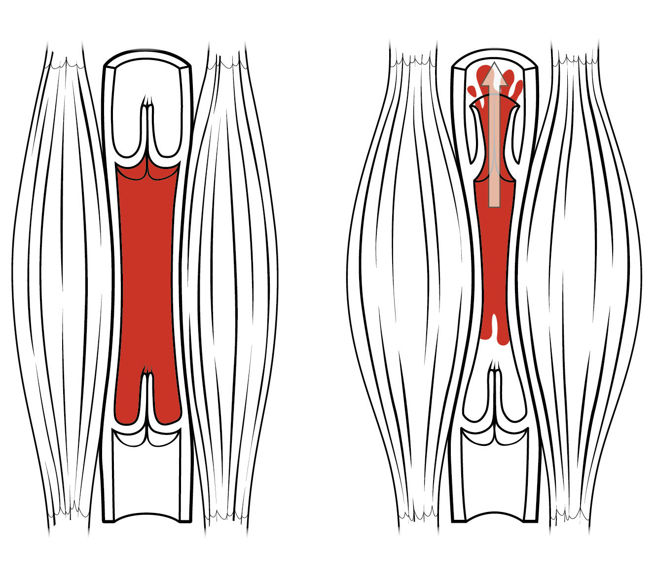 By OpenStax College - Anatomy &amp; Physiology, Connexions Web site. http://cnx.org/content/col11496/1.6/, Jun 19, 2013., CC BY 3.0, 